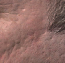 focus on a mature skin with wrinkles and marks